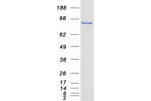 Validation with Western Blot