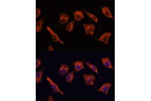 Immunofluorescence (IF) image for anti-Mucosa Associated Lymphoid Tissue Lymphoma Translocation Gene 1 (MALT1) (AA 125-450) antibody (ABIN3023032)