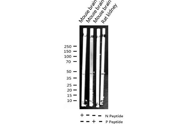 NFKBIB Antikörper  (pSer23)