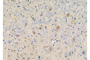 Phospho-Synapsin I (Ser62/Ser67) Antibody at 1/100 staining Rat brain tissue by IHC-P. (SYN1 Antikörper  (pSer62, pSer67))