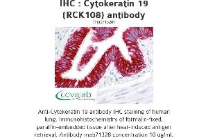 Image no. 1 for anti-Keratin 19 (KRT19) antibody (ABIN1724421) (Cytokeratin 19 Antikörper)
