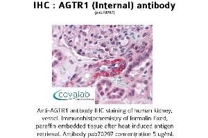 Image no. 2 for anti-Angiotensin II Receptor, Type 1 (AGTR1) (Internal Region) antibody (ABIN1731610) (Angiotensin II Type-1 Receptor Antikörper  (Internal Region))