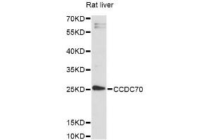 Western blot analysis of extracts of rat liver, using CCDC70 antibody (ABIN6292810) at 1:3000 dilution. (CCDC70 Antikörper)
