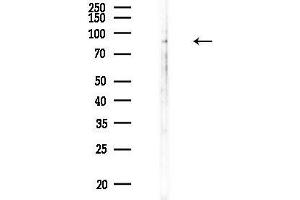 Western blot analysis of lysates from Rat testis, using CDH18 Antibody at 1/1000 dilution.
