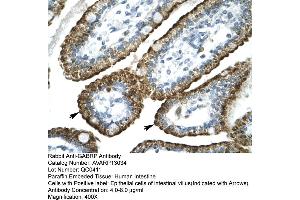 Human Intestine (GABRP Antikörper  (N-Term))