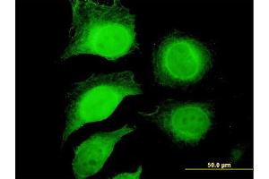 Immunofluorescence of purified MaxPab antibody to GAPDH on HeLa cell. (GAPDH Antikörper  (AA 1-335))
