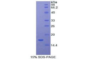 SDS-PAGE analysis of Rat Lysozyme Protein. (LYZ Protein)