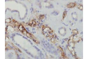 Immunohistochemistry (IHC) image for anti-Complement Component C4d (C4d) antibody (ABIN870587)