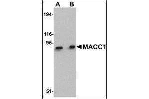 Western blot analysis of MACC1 in mouse liver tissue lysate with this product at (A) 1 and (B) 2 μg/ml.