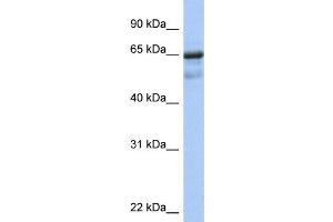 WB Suggested Anti-PCK1 Antibody Titration:  0. (PCK1 Antikörper  (N-Term))
