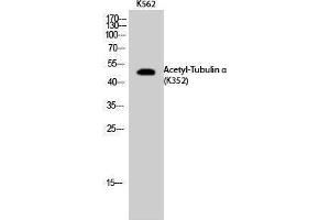 Western Blotting (WB) image for anti-alpha Tubulin (TUBA1) (acLys352) antibody (ABIN3172845) (alpha Tubulin Antikörper  (acLys352))