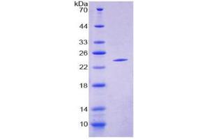 Image no. 1 for Crystallin, alpha B (CRYAB) (AA 1-175) protein (His tag) (ABIN6236940) (CRYAB Protein (AA 1-175) (His tag))