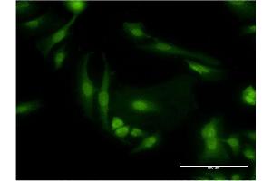 Immunofluorescence of monoclonal antibody to PDE6D on HeLa cell. (PDE6D Antikörper  (AA 1-150))