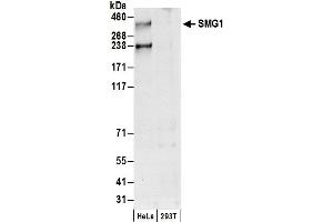 anti-pi-3-Kinase-Related Kinase SMG-1 (SMG1) (AA 1625-1675) antibody