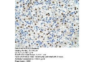 Rabbit Anti-EXOSC4 Antibody  Paraffin Embedded Tissue: Human Liver Cellular Data: Hepatocytes Antibody Concentration: 4.