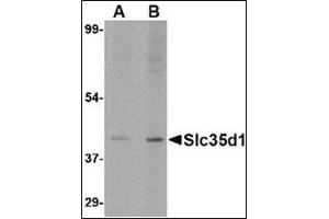 Western blot analysis of Slc35D1 inA-20 lysate with Slc35D1 antibody at (A) 1 and (B) 2 µg/ml. (SLC35D1 Antikörper  (N-Term))