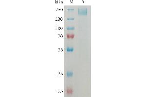 Mouse Protein, His Tag on SDS-PAGE under reducing condition.