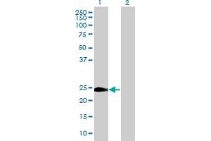 Western Blot analysis of WISP2 expression in transfected 293T cell line by WISP2 MaxPab polyclonal antibody. (WISP2 Antikörper  (AA 1-250))