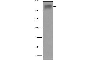 Western blot analysis of Thyroglobulin expression in Human thyroid lysate.