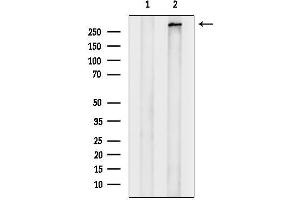 Western blot analysis of lysates from DU145 cells, using ABC Antibody.