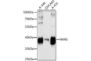 Western blot analysis of extracts of various cell lines, using NANS antibody (ABIN6291679) at 1:3000 dilution. (NANS Antikörper)