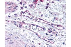 Staining of Vascular Endothelium 40X in human lung using EGLN1 polyclonal antibody . (EGLN1 Antikörper)