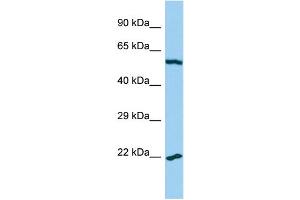 Host: Rabbit Target Name: MRPL32 Sample Type: U937 Whole Cell lysates Antibody Dilution: 1. (MRPL32 Antikörper  (C-Term))