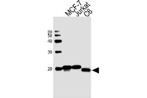 Sample Tissue/Cells lysates probed with antibodyname Monoclonal Antibody, unconjugated (bsm-51413M) at 1:1000 overnight at 4°C followed by a conjugated secondary antibody for 60 minutes at Room Temperature. (NME1 Antikörper)