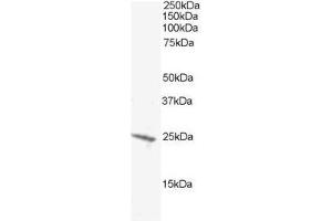 Image no. 1 for anti-BCL2-Antagonist/killer 1 (BAK1) (N-Term) antibody (ABIN374174)