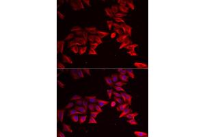 Immunofluorescence analysis of HeLa cell using SFRP4 antibody. (SFRP4 Antikörper)