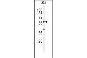 Image no. 1 for anti-serine Palmitoyltransferase, Long Chain Base Subunit 1 (SPTLC1) (N-Term) antibody (ABIN357775) (SPTLC1 Antikörper  (N-Term))