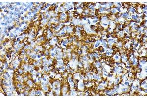 Immunohistochemistry of paraffin-embedded Human tonsil using CSNK1A1 Polyclonal Antibody at dilution of 1:100 (40x lens). (CSNK1A1 Antikörper)