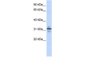 WB Suggested Anti-RPIA Antibody Titration: 0. (Ribose 5-Phosphate Isomerase A (RPIA) (N-Term) Antikörper)
