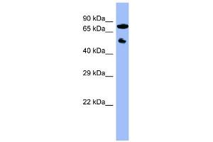 WB Suggested Anti-CYP11B2 Antibody Titration:  0. (CYP11B2 Antikörper  (Middle Region))