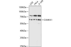 Western blot analysis of extracts of various cell lines, using C antibody (ABIN7266022) at 1:1000 dilution. (CAMKK1 Antikörper  (AA 399-520))
