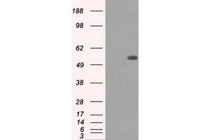 Image no. 2 for anti-Fumarate Hydratase (FH) antibody (ABIN1498269)