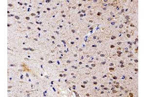 IHC analysis of FKBP135/FKBP15 using anti-FKBP135/FKBP15 antibody (ABIN7600397). (FKBP15 Antikörper  (AA 19-1210))