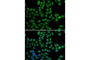 Immunofluorescence analysis of U2OS cell using LMNB2 antibody. (Lamin B2 Antikörper)
