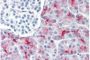 Human Pancreas (formalin-fixed, paraffin-embedded) stained with MUC1 antibody ABIN334252 at 1:50 followed by biotinylated anti-mouse IgG secondary antibody ABIN481714, alkaline phosphatase-streptavidin and chromogen. (MUC1 Antikörper  (FITC))
