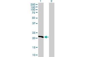 Western Blot analysis of DHFR expression in transfected 293T cell line by DHFR MaxPab polyclonal antibody. (Dihydrofolate Reductase Antikörper  (AA 1-187))