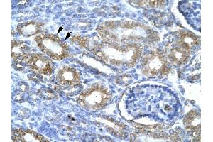 CDK7 antibody was used for immunohistochemistry at a concentration of 4-8 ug/ml to stain Epithelial cells of renal tubule (lndicated with Arrows] in Human Kidney. (CDK7 Antikörper  (C-Term))