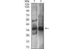 Western blot analysis using EPCAM mouse mAb against A431 (1), MCF-7 (2) cell lysate.