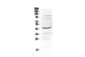 Western blot analysis of IL12B using anti-IL12B antibody . (IL12B Antikörper  (AA 23-250))