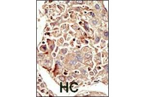 Immunohistochemistry (Paraffin-embedded Sections) (IHC (p)) image for anti-Activin Receptor Type I (ACRV1) (AA 132-162) antibody (ABIN392240)