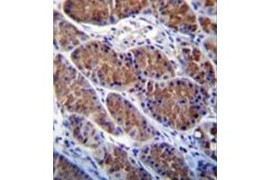 Immunohistochemistry analysis in formalin fixed and paraffin embedded human stomach tissue reacted with Otopetrin-1 Antibody (Center) followed which was peroxidase conjugated to the secondary antibody and followed by DAB staining.
