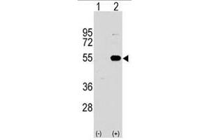 Image no. 2 for anti-Sprouty-Related, EVH1 Domain Containing 1 (SPRED1) (N-Term) antibody (ABIN356947) (SPRED1 Antikörper  (N-Term))