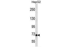 CHD1L Antibody (Center) western blot analysis in HepG2 cell line lysates (35µg/lane). (CHD1L Antikörper  (Middle Region))