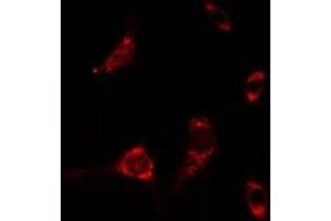 ABIN6275471 staining A549 cells by IF/ICC.