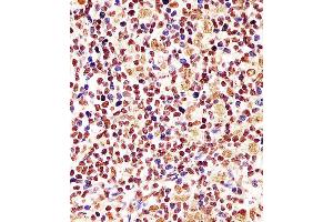 Antibody staining Cyclin D1 in human tonsil tissue sections by Immunohistochemistry (IHC-P - paraformaldehyde-fixed, paraffin-embedded sections). (Cyclin D1 Antikörper  (AA 68-97))