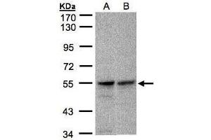 WB Image Sample(30 ug whole cell lysate) A:A431, B:Raji , 7. (FOXRED1 Antikörper)